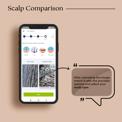 Florida Beauty Labs Smart Camera Scalp Analyzer | Smart Wireless Scalp Analyzer camera | 1000mAH Battery